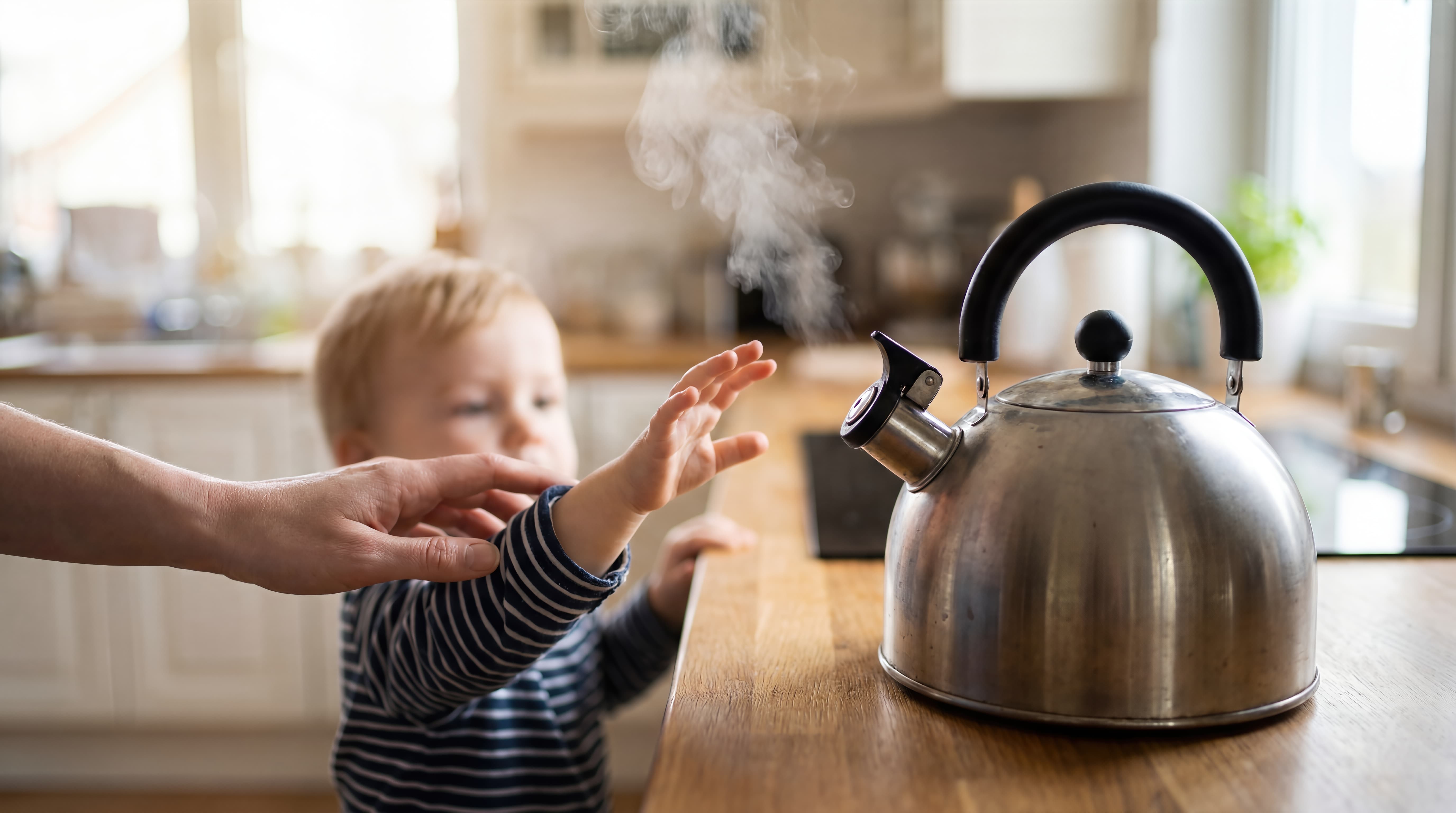 Spilled Hot Water in Your Hotel? Proper First Aid and Ointment Prescriptions for Sudden Burns on Vacation