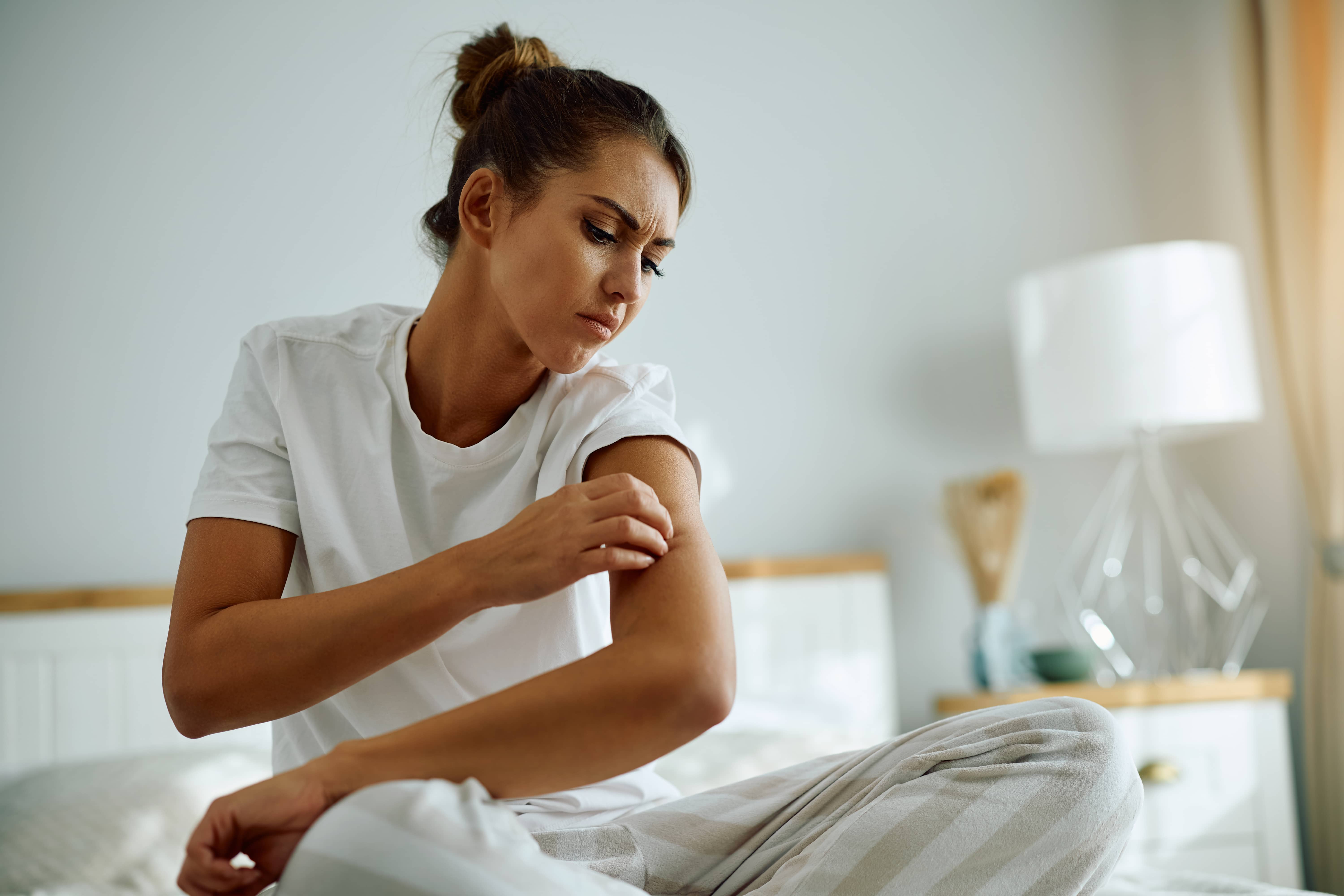 旅客在日本飯店或旅館睡醒後皮膚出現搔癢紅疹